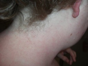 backneck