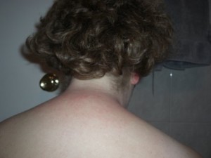 backneck2