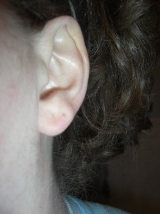 Normal Sized Ear